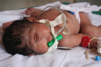 PIC 9 [Fig 7] cyclops1